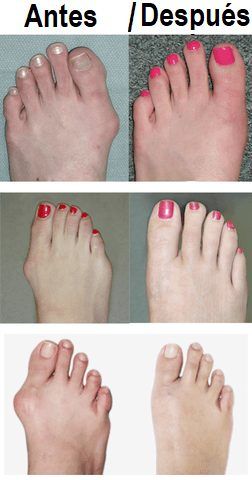 antes y despues